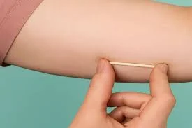 Alenquer está entre os 43 municípios do Pará que passam a ofertar Implanon pelo SUS